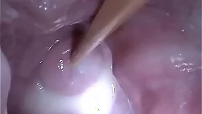 Insertion Semen Cum in Cervix Wide Stretching Pussy Send back